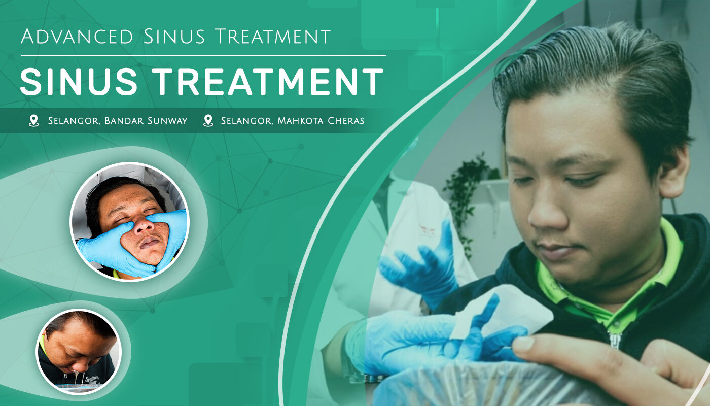 Sinusitis Treatment Center Selangor